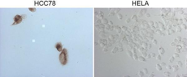 m04186 anti ros1 mouse monoclonal antibody clone id oti1f3 if testing 7