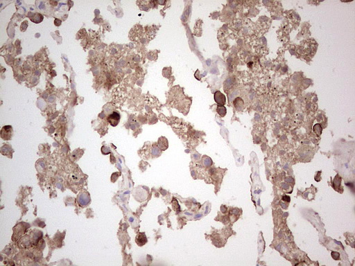 m04186 anti ros1 mouse monoclonal antibody clone id oti1f3 ihc testing 4