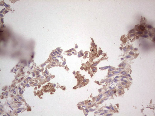 m04186 anti ros1 mouse monoclonal antibody clone id oti1f3 ihc testing 5