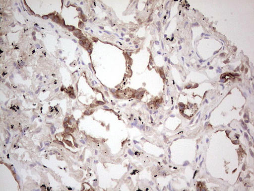 m04186 anti ros1 mouse monoclonal antibody clone id oti1f3 ihc testing 6