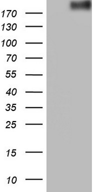 HEK293T cells were transfected with the pCMV6-ENTRY control (Left lane) or pCMV6-ENTRY ROS1 (Right lane) cDNA for 48 hrs and lysed