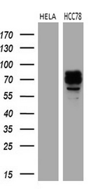 Western blot analysis of extracts (35ug) from 2 different cell lines by using anti-ROS1 monoclonal antibody (1:500)