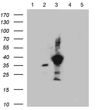 m04188 anti somatostatin receptor 3 sstr3 mouse monoclonal antibody clone id oti9a7 wb testing 1