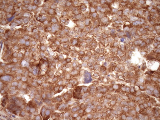 m04190 anti rpl10 mouse monoclonal antibody clone id oti6b11 ihc testing 2