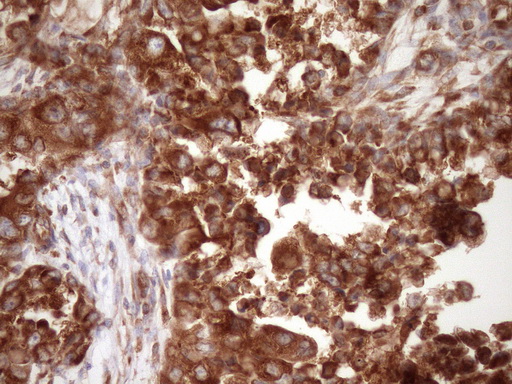 m04190 anti rpl10 mouse monoclonal antibody clone id oti6b11 ihc testing 3