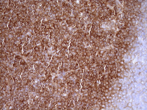 m04190 anti rpl10 mouse monoclonal antibody clone id oti6b11 ihc testing 4
