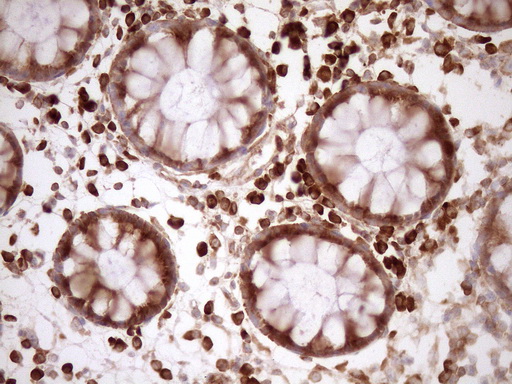 m04190 anti rpl10 mouse monoclonal antibody clone id oti6b11 ihc testing 5