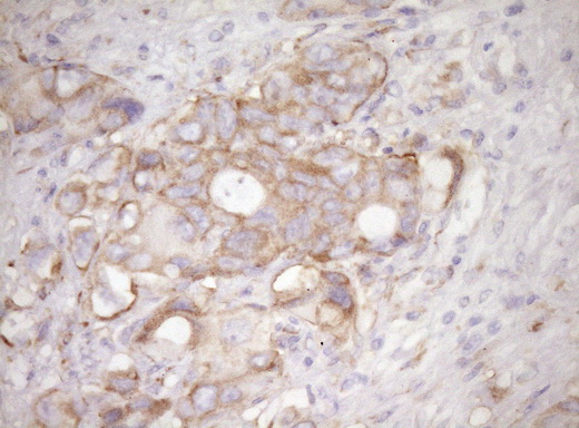 m04190 anti rpl10 mouse monoclonal antibody clone id oti6b11 ihc testing 6