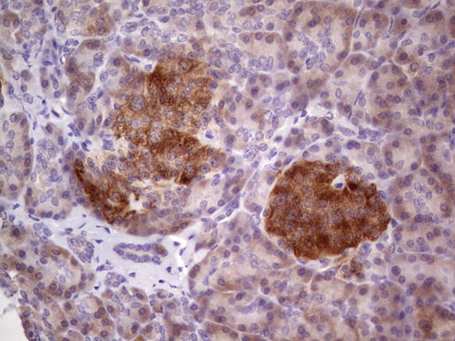 m04196 anti tacc1 mouse monoclonal antibody clone id oti1h2 ihc testing 2