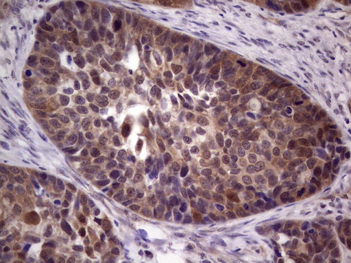 m04196 anti tacc1 mouse monoclonal antibody clone id oti1h2 ihc testing 3