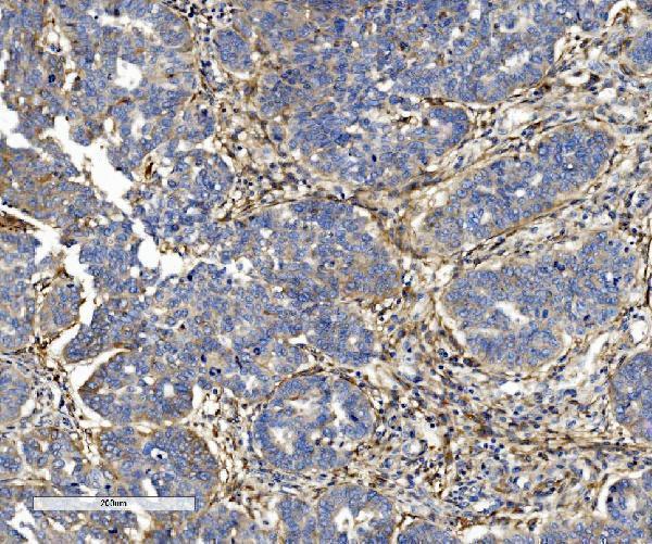 m04201 itgb5 primary antibodies ihc testing 3