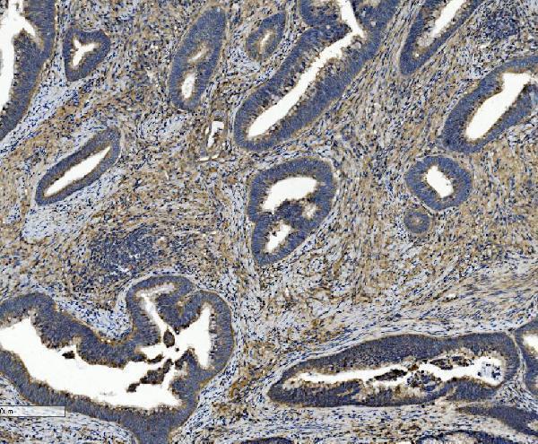 m04201 itgb5 primary antibodies ihc testing 4