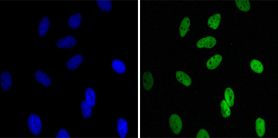 Immunofluorescence analysis of Hela cells using CBX1 Monoclonal Antibody (green)