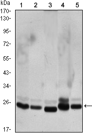 Western Blot analysis using CBX1 Monoclonal Antibody against HeLa (1), COS7 (2), NIH/3T3 (3), A431 (4), and C6 (5) cell lysate