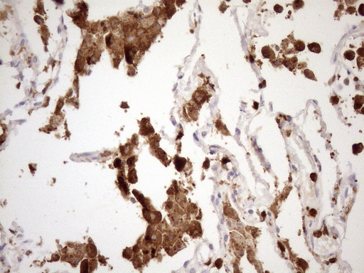 m04208 anti ncf4 mouse monoclonal antibody clone id oti4b5 ihc testing 5