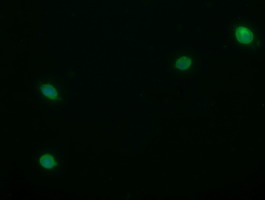 m04221 anti trim22 mouse monoclonal antibody clone id oti1d11 if testing 6