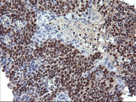m04221 anti trim22 mouse monoclonal antibody clone id oti1d11 ihc testing 4