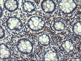 m04221 anti trim22 mouse monoclonal antibody clone id oti1d11 ihc testing 5