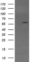 HEK293T cells were transfected with the pCMV6-ENTRY control (Left lane) or pCMV6-ENTRY TRIM22 (Right lane) cDNA for 48 hrs and lysed