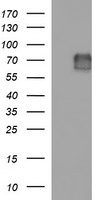 HEK293T cells were transfected with the pCMV6-ENTRY control (Left lane) or pCMV6-ENTRY MADCAM1 (Right lane) cDNA for 48 hrs and lysed