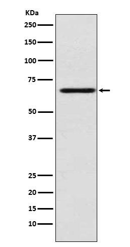 Western blot analysis of MADCAM1 expression in HUVEC cell lysate