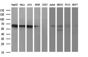 Western blot analysis of extracts (35ug) from 9 different cell lines by using anti-MADCAM1 monoclonal antibody (HepG2: human; HeLa: human; SVT2: mouse; A549: human; COS7: monkey; Jurkat: human; MDCK: canine; PC12: rat; MCF7: human)