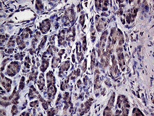 Immunohistochemical staining of paraffin-embedded Human pancreas tissue within the normal limits using anti-HABP2 mouse monoclonal antibody