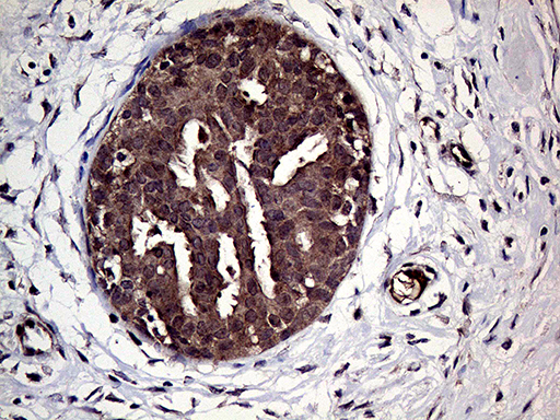 Immunohistochemical staining of paraffin-embedded Human breast tissue within the normal limits using anti-HABP2 mouse monoclonal antibody