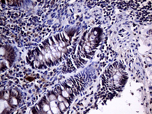 m04235 anti habp2 mouse monoclonal antibody clone id oti5h3 ihc testing 4
