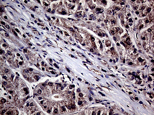 m04235 anti habp2 mouse monoclonal antibody clone id oti5h3 ihc testing 5