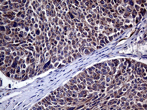 m04235 anti habp2 mouse monoclonal antibody clone id oti5h3 ihc testing 6