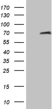 HEK293T cells were transfected with the pCMV6-ENTRY control (Left lane) or pCMV6-ENTRY FLJ40504 (Right lane) cDNA for 48 hrs and lysed
