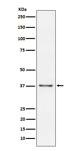 Western blot analysis of CD23 expression in Raji cell lysate