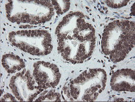 m04240 1 anti chn 1 chn1 mouse monoclonal antibody clone id oti2g6 ihc testing 10