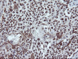 m04240 1 anti chn 1 chn1 mouse monoclonal antibody clone id oti2g6 ihc testing 11