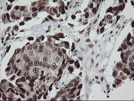m04240 1 anti chn 1 chn1 mouse monoclonal antibody clone id oti2g6 ihc testing 13