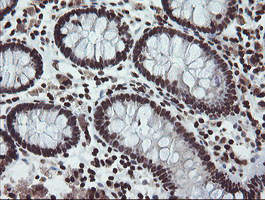 m04240 1 anti chn 1 chn1 mouse monoclonal antibody clone id oti2g6 ihc testing 14