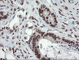 m04240 1 anti chn 1 chn1 mouse monoclonal antibody clone id oti2g6 ihc testing 15