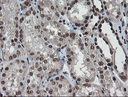 m04240 1 anti chn 1 chn1 mouse monoclonal antibody clone id oti2g6 ihc testing 16
