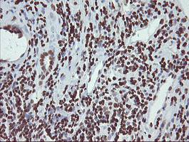 m04240 1 anti chn 1 chn1 mouse monoclonal antibody clone id oti2g6 ihc testing 17