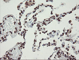m04240 1 anti chn 1 chn1 mouse monoclonal antibody clone id oti2g6 ihc testing 20