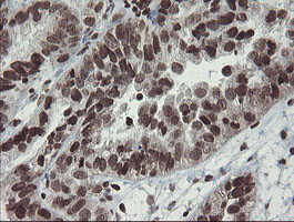 m04240 1 anti chn 1 chn1 mouse monoclonal antibody clone id oti2g6 ihc testing 4