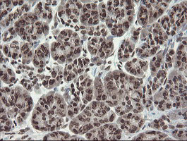 m04240 1 anti chn 1 chn1 mouse monoclonal antibody clone id oti2g6 ihc testing 5