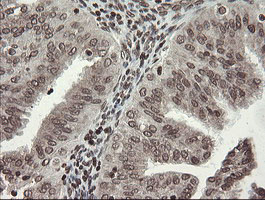 m04240 1 anti chn 1 chn1 mouse monoclonal antibody clone id oti2g6 ihc testing 7