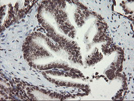 m04240 1 anti chn 1 chn1 mouse monoclonal antibody clone id oti2g6 ihc testing 8