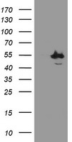 HEK293T cells were transfected with the pCMV6-ENTRY control (Left lane) or pCMV6-ENTRY CHN1 (Right lane) cDNA for 48 hrs and lysed