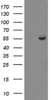 HEK293T cells were transfected with the pCMV6-ENTRY control (Left lane) or pCMV6-ENTRY CHN1 (Right lane) cDNA for 48 hrs and lysed