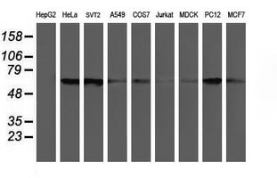Western blot analysis of extracts (35ug) from 9 different cell lines by usin g anti-CHN1 monoclonal antibody (HepG2: human; HeLa: human; SVT2: mouse; A549: human; COS7: monkey; Jurkat: human; MDCK: canine; PC12: rat; MCF7: human)