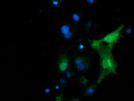 m04244 1 anti pip5k2 alpha pip4k2a mouse monoclonal antibody clone id oti1b2 if testing 5