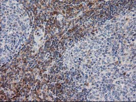 Immunohistochemical staining of paraffin-embedded Human lymph node tissue within the normal limits using anti-PIP4K2A mouse monoclonal antibody
